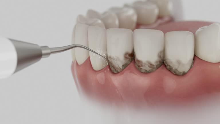Trusted Dental Crowns And Bridges service in Nashville, AR - Dentist Open Now